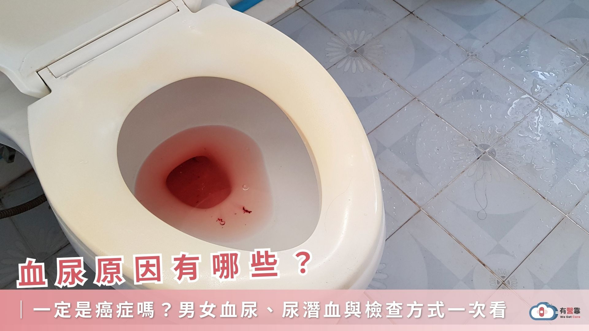 血尿原因有哪些？一定是癌症嗎？男女血尿、尿潛血與檢查方式一次看