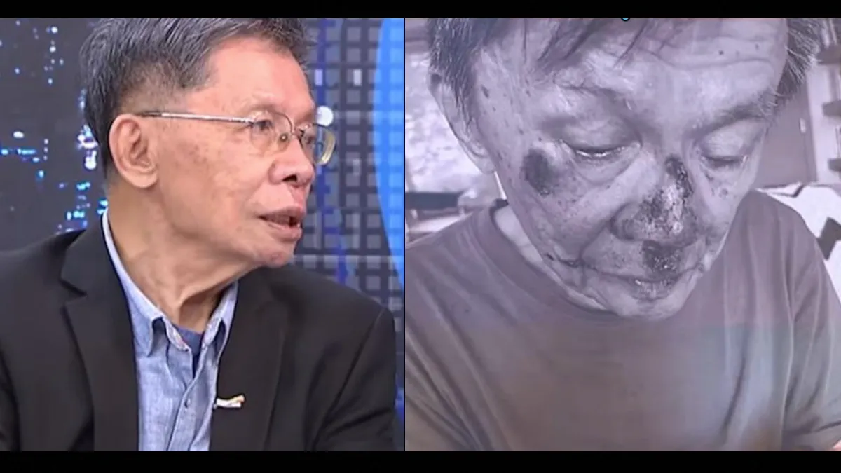 健康星聞87歲沈富雄重摔流血！醫教「1招」摔倒保命動作 開眼單腳站10秒自測