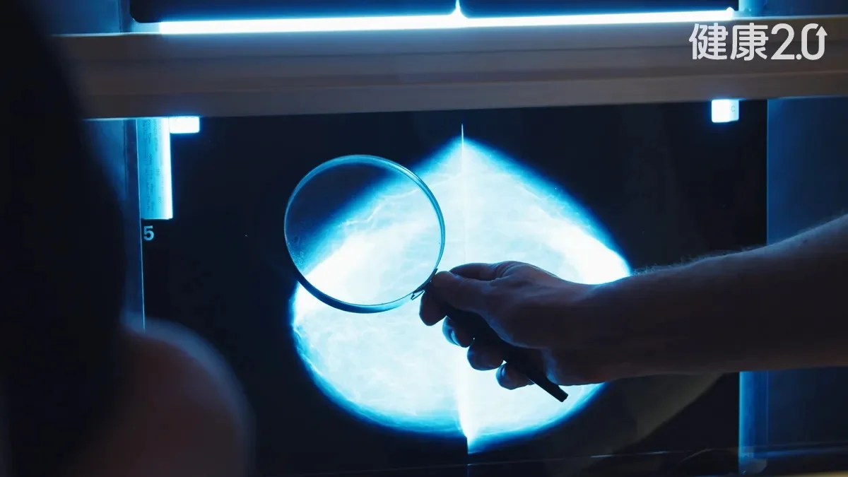 腫瘤僅1公分竟已4期！60歲婦陪病意外驗出乳癌末期 這兩類乳癌最凶猛 - Yahoo新聞