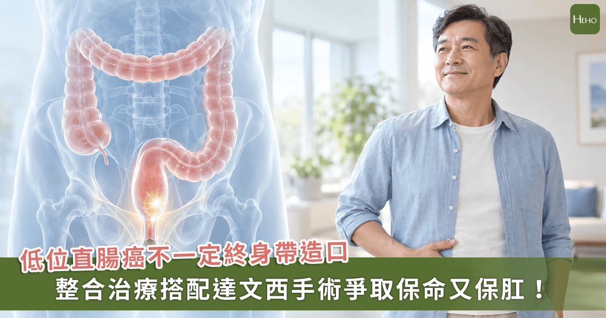 拒絕一輩子掛便袋！晚期直腸癌「先縮小、再手術」提升生活品質