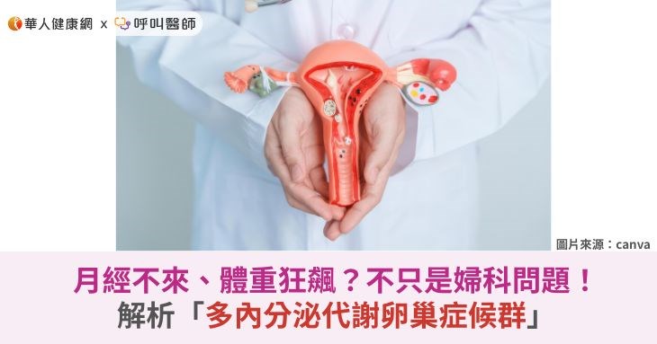 月經不來、體重狂飆？不只是婦科問題！解析「多內分泌代謝卵巢症候群」