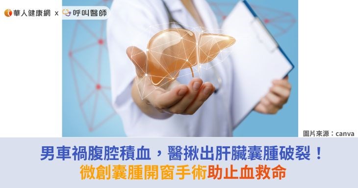 男車禍腹腔積血，醫揪出肝臟囊腫破裂！微創囊腫開窗手術助止血救命