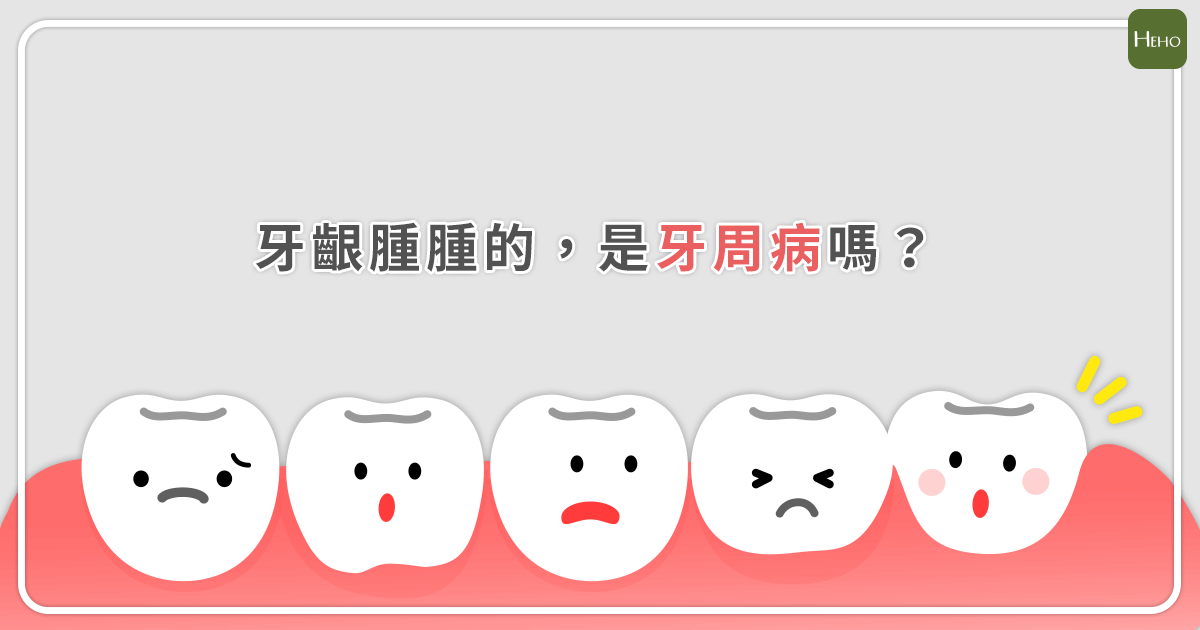牙齦腫是牙周病嗎？醫師教你用 4 招「紅、腫、軟、鬆」判斷