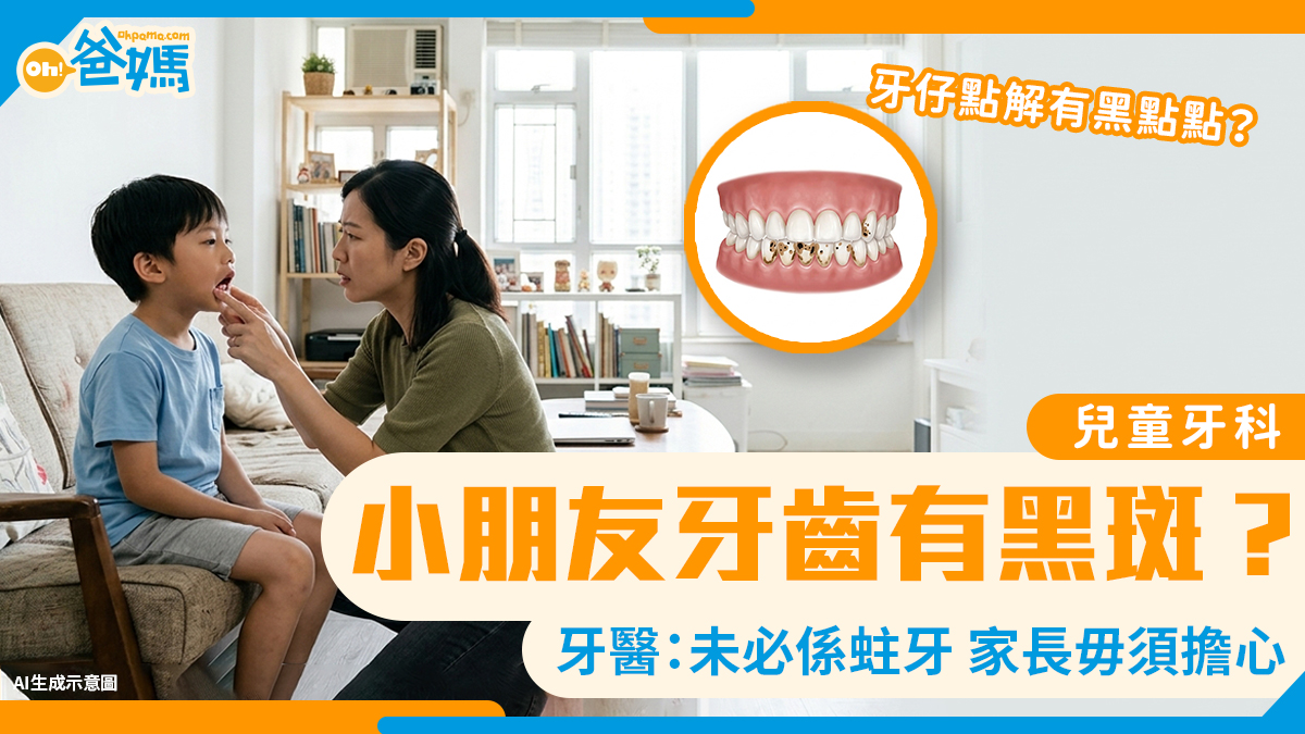 牙齒「黑黑的」是否蛀牙？兒童牙科專科醫師：家長毋須過度擔心 - 星島頭條
