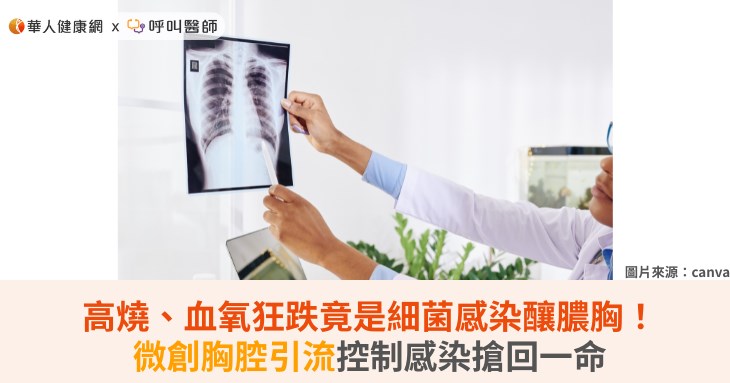 高燒、血氧狂跌竟是細菌感染釀膿胸！微創胸腔引流控制感染搶回一命