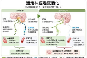 科普好健康／迷走神經暈厥 缺水引起腦部暫時供血不足
