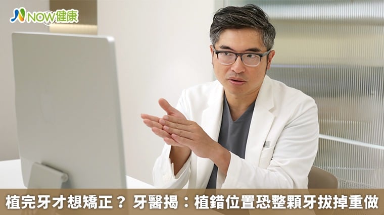 植完牙才想矯正？ 牙醫揭：植錯位置恐整顆牙拔掉重做- 健康新聞 - news.pchome.com.tw