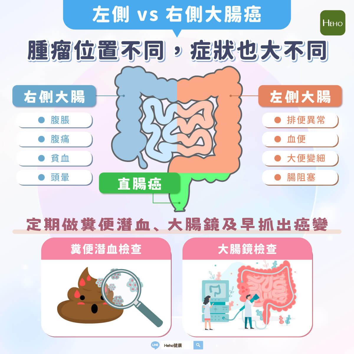 右側大腸癌、左側大腸癌有何不同？醫師提醒：腫瘤位置不同，症狀也不一樣