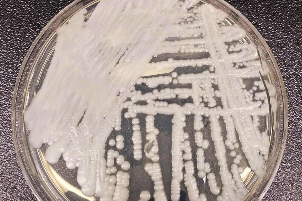四大類抗黴菌藥全失效，肯亞現全球第二例「全抗藥性」耳念珠菌感染 - TechNews 科技新報