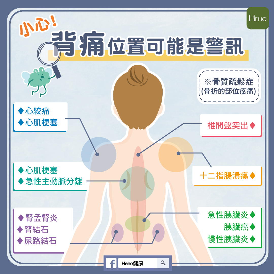 小心！背痛位置可能是警訊：一圖看懂內臟器官與背痛關聯