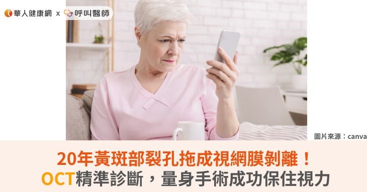 20年黃斑部裂孔拖成視網膜剝離！OCT精準診斷，量身手術成功保住視力