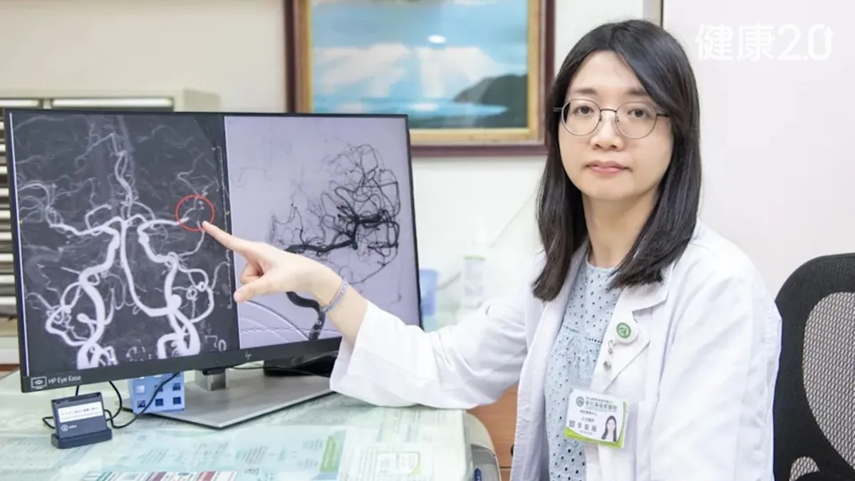 醫療焦點71歲婦急性腦中風又心跳驟停！彰基跨科接力搶救 如今能自己煮飯