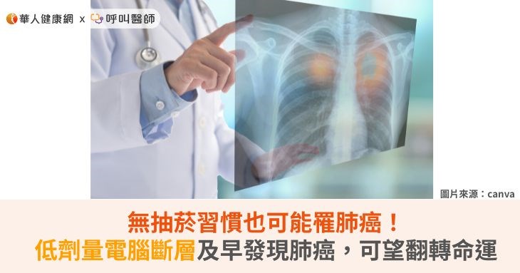 無抽菸習慣也可能罹肺癌！低劑量電腦斷層及早發現肺癌，可望翻轉命運