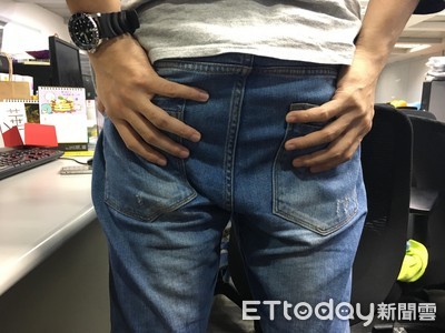 肛門口摸到「硬硬一顆」！25歲男熬夜就腫大　醫：這要手術了