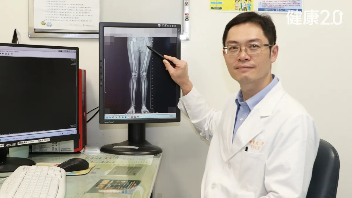 大學生腳痛竟是早發性髖節炎 只吃止痛藥，41歲換人工髖關節