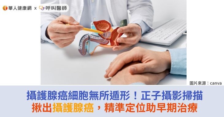 攝護腺癌細胞無所遁形！正子攝影掃描揪出攝護腺癌，精準定位助早期治療