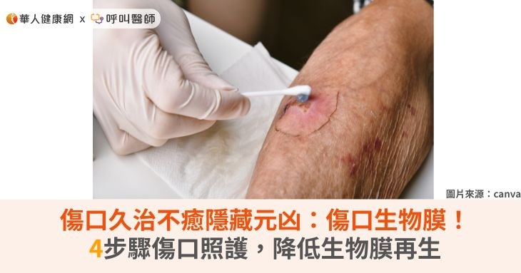 傷口久治不癒隱藏元凶：傷口生物膜！4步驟傷口照護，降低生物膜再生