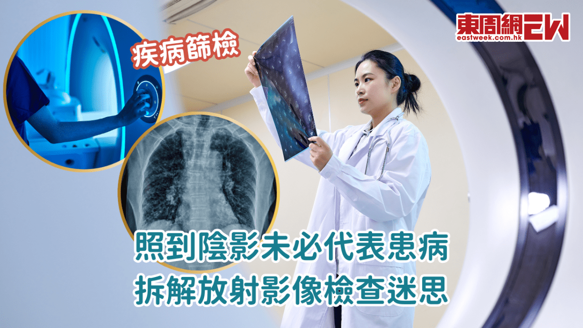 照到陰影未必代表患病 拆解放射影像檢查迷思 - Eastweek
