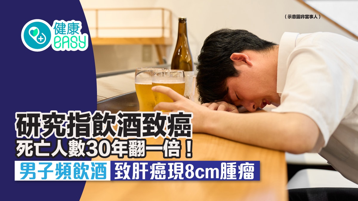 研究指飲酒致癌死亡人數30年翻一倍！男子頻飲酒致肝癌現8cm腫瘤 - 香港01