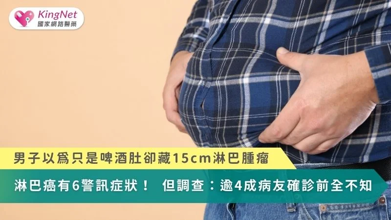 以為啤酒肚竟藏15cm淋巴瘤！淋巴癌6警訊 調查：逾4成病友確診前全不知