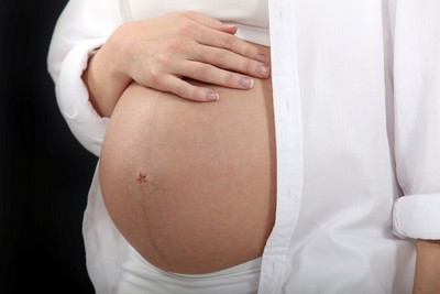 孕婦引產常用藥缺貨　醫：替代藥恐增剖腹產、子宮破裂風險