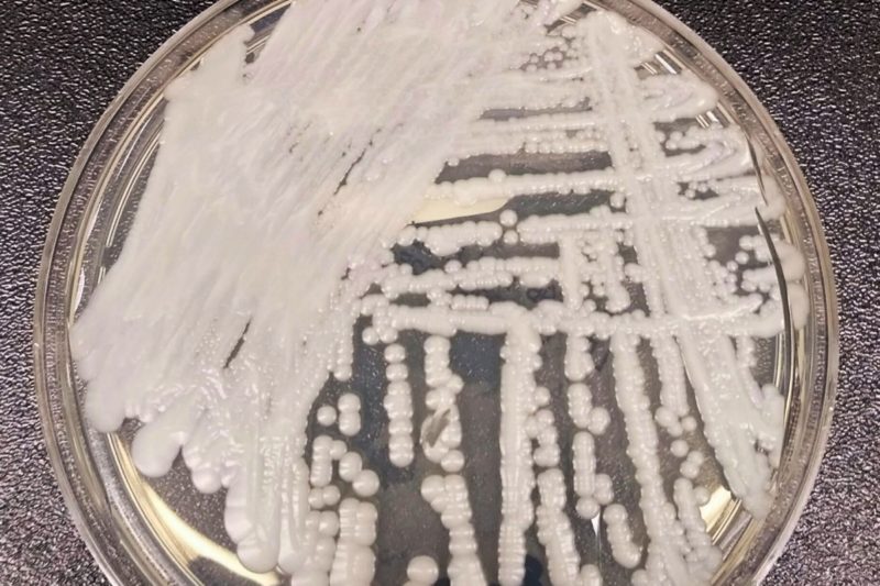 四大類抗黴菌藥全失效，肯亞現全球第二例「全抗藥性」耳念珠菌感染- 股市爆料同學會 - CMoney