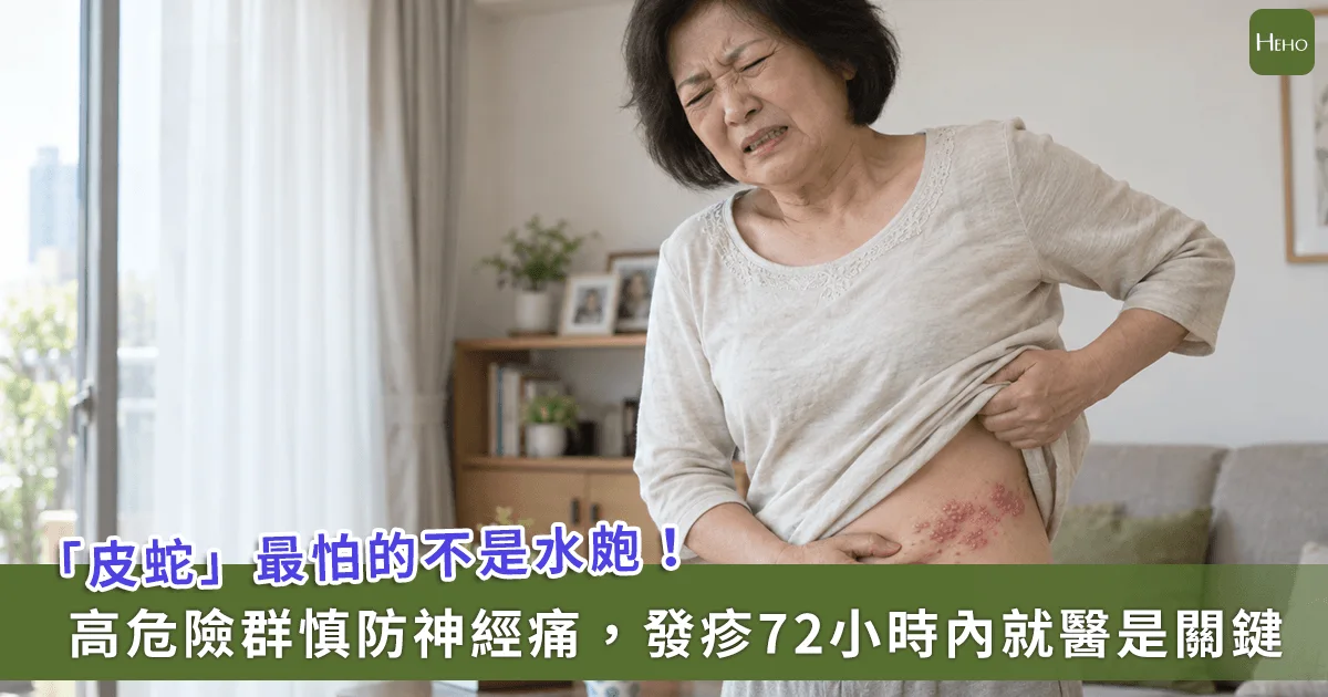 「皮蛇」最怕後遺症？高危險群外用藥膏對神經痛完全無效！72 小時內就醫是關鍵 - Yahoo新聞