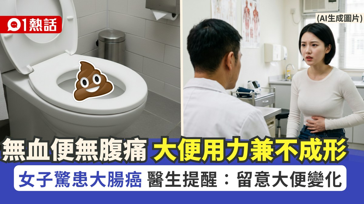 無血便無腹痛！女子要大便愈來愈用力兼糞便不成形 驚揭患大腸癌 - 香港01