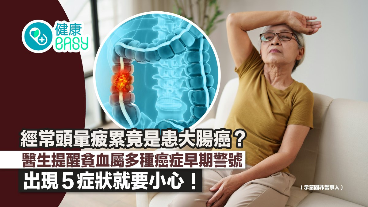 長期頭暈別只補鐵 小心貧血背後隱藏大腸癌 疲累+走路喘快就醫 - 香港01