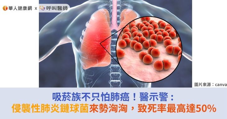 吸菸族不只怕肺癌！醫示警 : 侵襲性肺炎鏈球菌來勢洶洶，致死率最高達50%