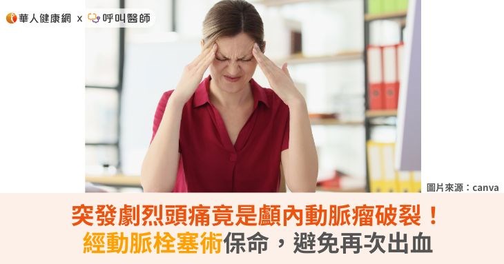 突發劇烈頭痛竟是顱內動脈瘤破裂！經動脈栓塞術保命，避免再次出血