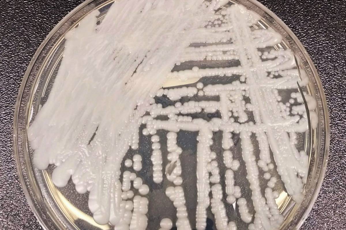 四大類抗黴菌藥全失效，肯亞現全球第二例「全抗藥性」耳念珠菌感染 | 科技新報 - LINE TODAY