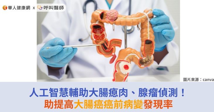 人工智慧輔助大腸瘜肉、腺瘤偵測！助提高大腸癌癌前病變發現率