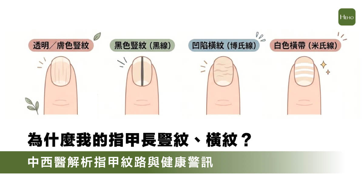 指甲有豎紋、波浪紋是生病前兆嗎？一張表看懂指甲紋路的健康警訊