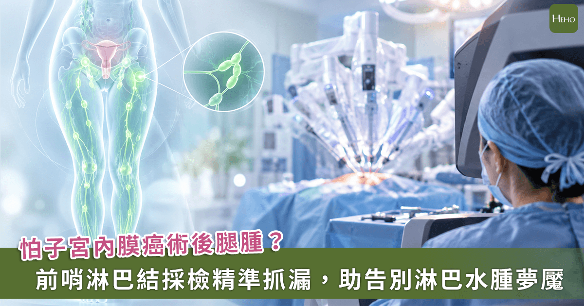 子宮內膜癌怕術後「腫成象皮腿」？新微創技術精準抓漏助告別淋巴水腫夢魘