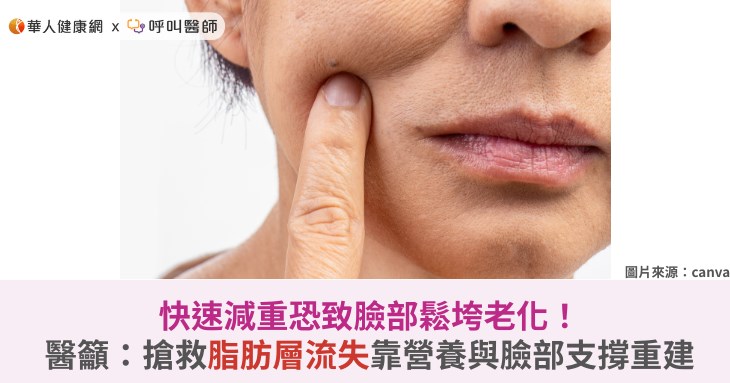 快速減重恐致臉部鬆垮老化！醫籲：搶救脂肪層流失靠營養與臉部支撐重建