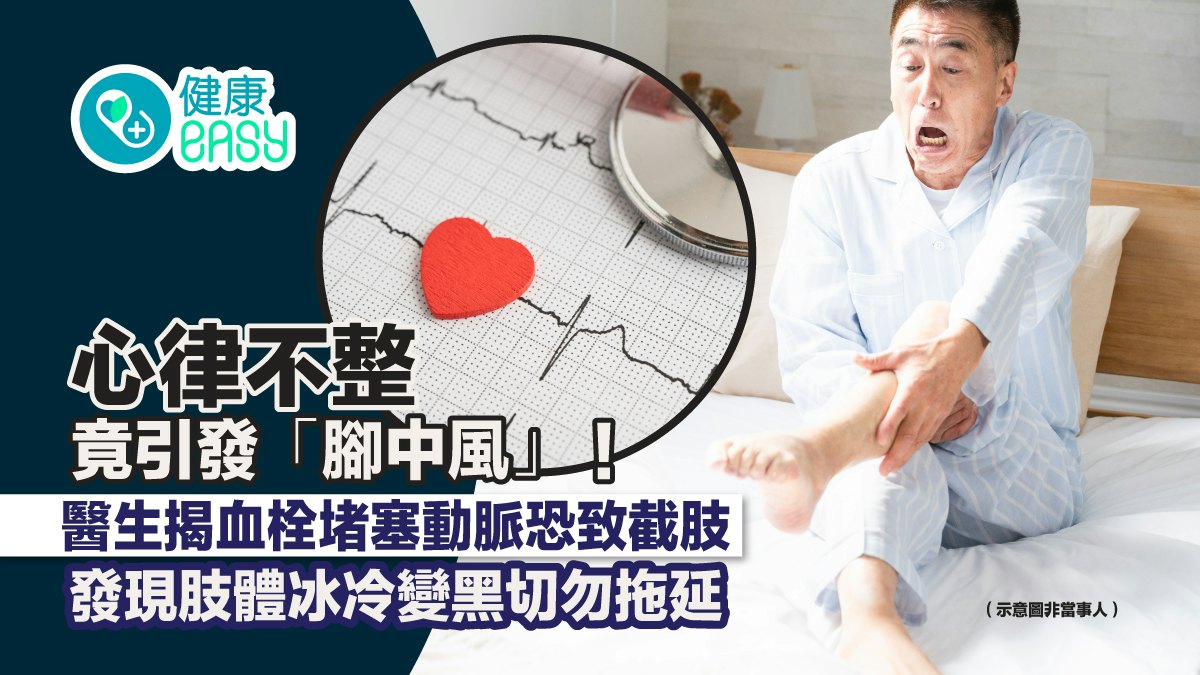 心律不整竟引發「腳中風」 6症狀是警號 腳變黑且疼痛要注意 - 香港01