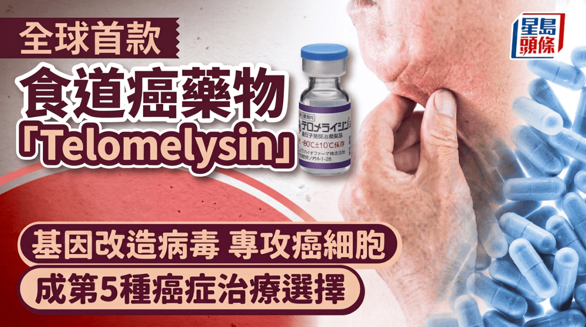 全球首款食道癌藥物「Telomelysin」面世！基因改造病毒專攻癌細胞 成第5種癌症治療選擇 - 星島頭條