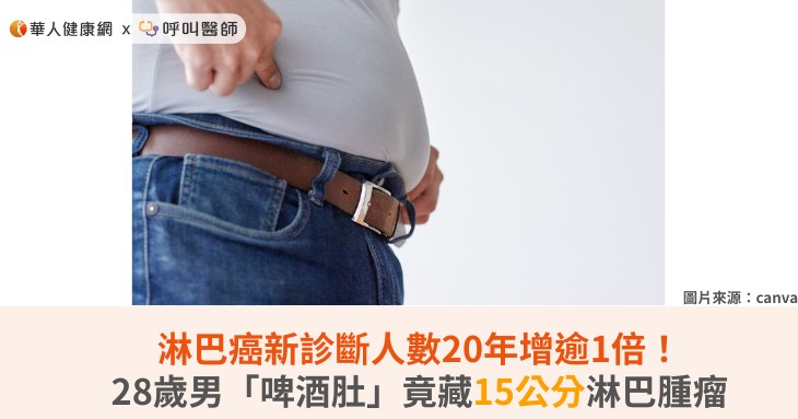 淋巴癌新診斷人數20年增逾1倍！28歲男「啤酒肚」竟藏15公分淋巴腫瘤