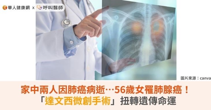 家中兩人因肺癌病逝…56歲女罹肺腺癌！「達文西微創手術」扭轉遺傳命運