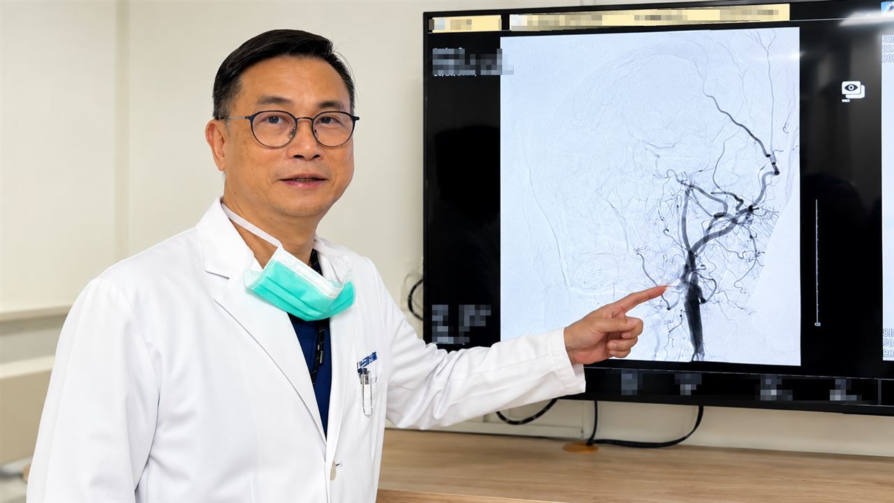 「乾燥症」攻擊血管腫脹發炎　害46歲女急性腦中風　醫師1手術成功搶命