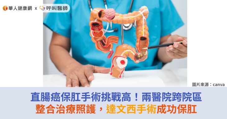 直腸癌保肛手術挑戰高！兩醫院跨院區整合治療照護，達文西手術成功保肛
