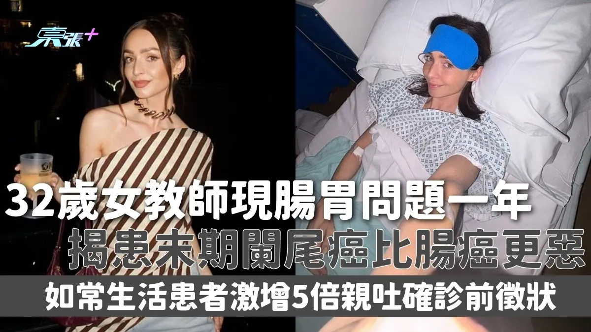 闌尾癌｜32歲女教師現腸胃問題一年揭患末期闌尾癌比腸癌更惡如常生活患者激增5倍親吐確診前徵狀- 東張+ - myTV SUPER
