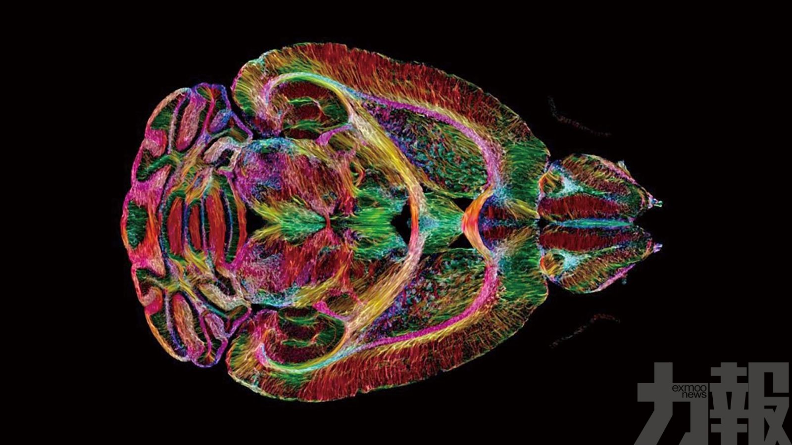 研究稱大腦實為兩器官 有望助攻漸凍症研究 - 澳門力報