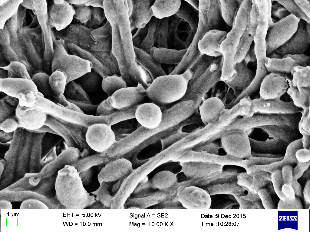 細菌分子 gladiolin 可「卸除」白色念珠菌武器，使其退回無害狀態 - TechNews 科技新報