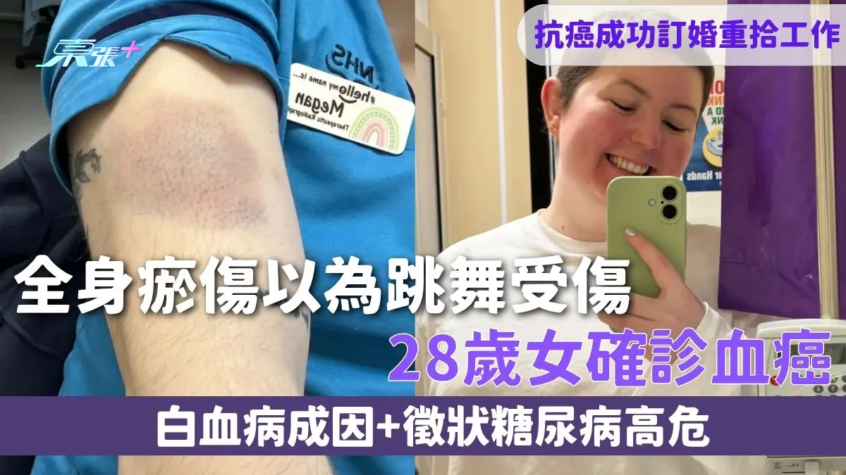 血癌｜全身瘀傷以為跳舞受傷28歲女確診血癌抗癌成功訂婚重拾工作白血病成因+徵狀糖尿病高危- 東張+ - myTV SUPER