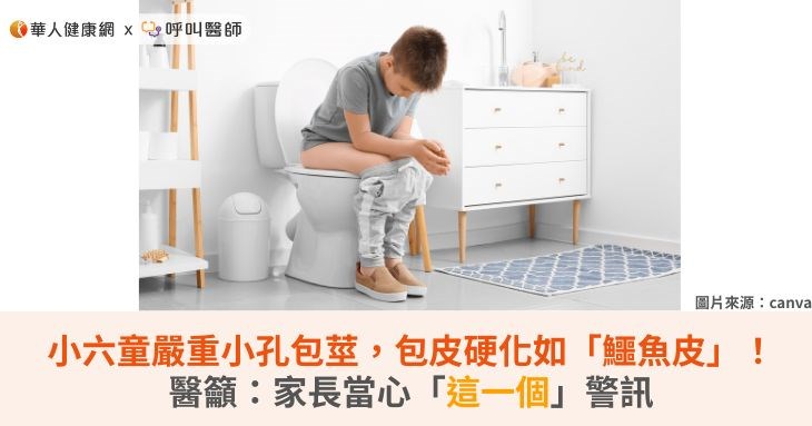 小六童嚴重小孔包莖，包皮硬化如「鱷魚皮」！醫籲：家長當心「這一個」警訊