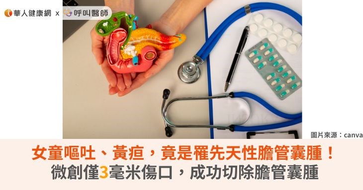 女童嘔吐、黃疸，竟是罹先天性膽管囊腫！微創僅3毫米傷口，成功切除膽管囊腫