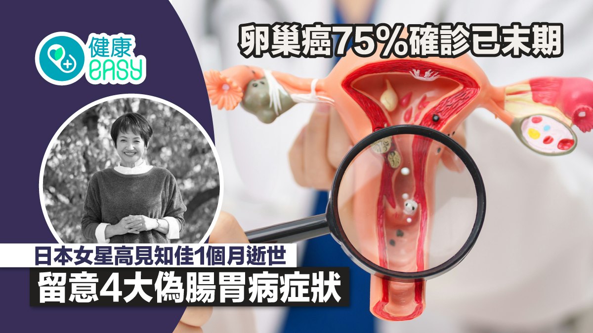 卵巢癌75%確診已末期 日本女星1個月逝世 留意4大偽腸胃病症狀 - 香港01