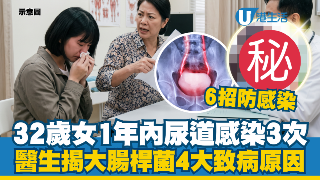 尿道炎反覆發作因為不乾淨？32歲女一年三次尿道炎！醫揭4大致病死穴 - UHK 港生活